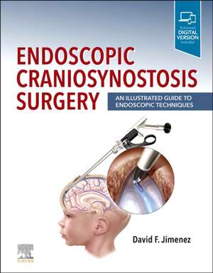 Endoscopic Craniosynostosis Surgery: An Illustrated Guide to Endoscopic Techniques de David F. Jimenez