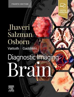 Diagnostic Imaging: Brain de Miral D. Jhaveri