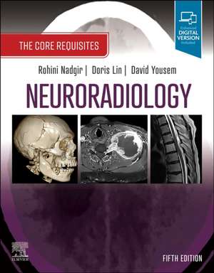 Neuroradiology: The Core Requisites de Rohini Nadgir