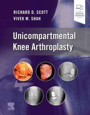 Unicompartmental Knee Arthroplasty de Richard D. Scott