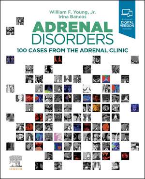 Adrenal Disorders: 100 Cases from the Adrenal Clinic de William F. Young