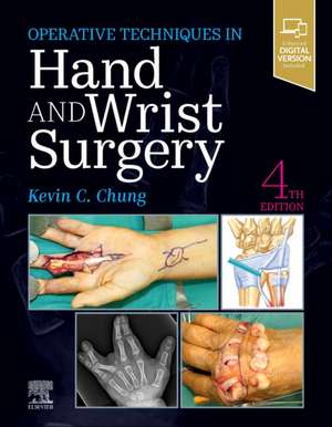 Operative Techniques: Hand and Wrist Surgery de Kevin C. Chung