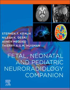 Fetal, Neonatal and Pediatric Neuroradiology de Stephen Kralik