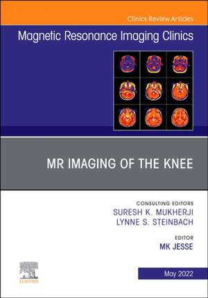 MR Imaging of The Knee, An Issue of Magnetic Resonance Imaging Clinics of North America de MK Jesse