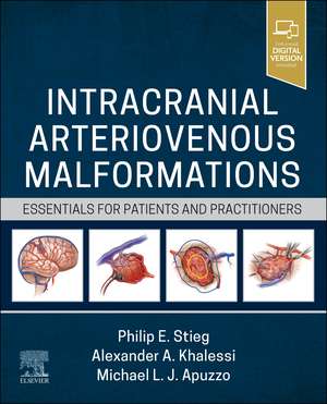 Intracranial Arteriovenous Malformations: Essentials for Patients and Practitioners de Philip E. Stieg