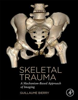 Skeletal Trauma: A Mechanism-Based Approach of Imaging de Guillaume Bierry