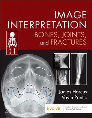 Image Interpretation: Bones, Joints, and Fractures de James Harcus