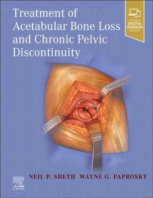 Treatment of Acetabular Bone Loss and Chronic Pelvic Discontinuity de Neil P. Sheth