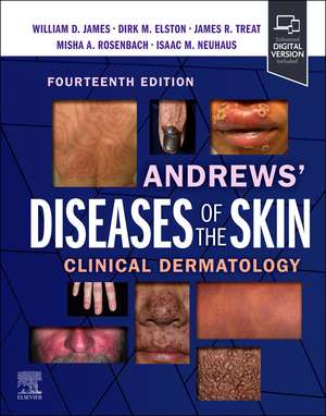 Andrews' Diseases of the Skin: Clinical Dermatology de William D. James