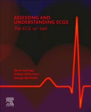 Assessing and Understanding ECGs: The ECG 10+ tool de Karen TS Konings