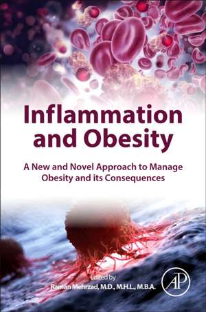 Inflammation and Obesity: A New and Novel Approach to Manage Obesity and its Consequences de Raman Mehrzad