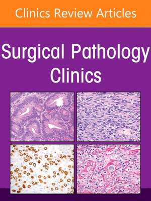 Genitourinary Pathology, An Issue of Surgical Pathology Clinics de Ming Zhou