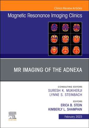 Vascular Anesthesia, An Issue of Anesthesiology Clinics de Megan P. Kostibas