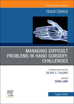 Managing Difficult Problems in Hand Surgery: Challenges, Complications and Revisions, An Issue of Hand Clinics de Sonu Jain