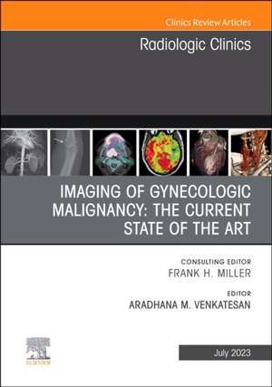 Imaging of Gynecologic Malignancy: The Current State of the Art, An Issue of Radiologic Clinics of North America de Aradhana M. Venkatesan