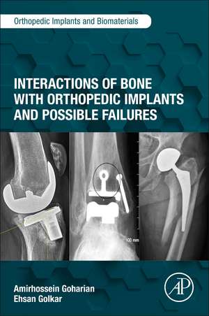 Interactions of Bone with Orthopedic Implants and Possible Failures de Amirhossein Goharian