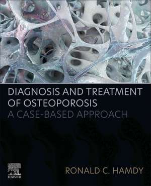 Diagnosis and Treatment of Osteoporosis: A Case-Based Approach de Ronald C. Hamdy