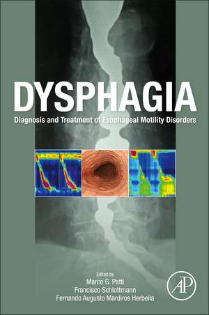 Dysphagia: Diagnosis and Treatment of Esophageal Motility Disorders de Marco G. Patti