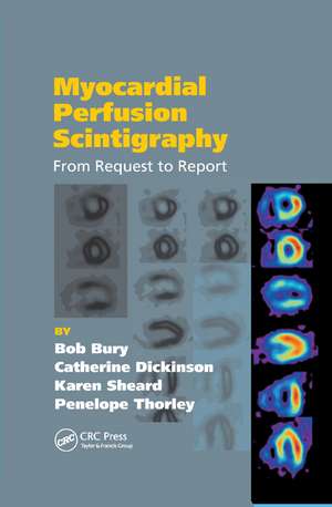 Myocardial Perfusion Scintigraphy: From Request to Report de Bob Bury