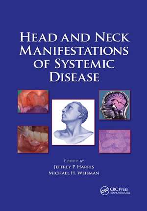 Head and Neck Manifestations of Systemic Disease de Jeffrey P. Harris