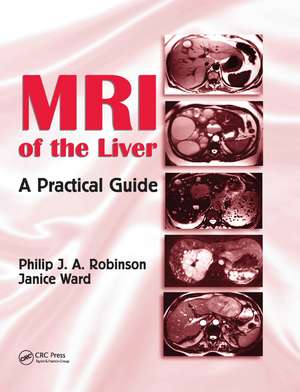 MRI of the Liver: A Practical Guide de Philip J. A. Robinson