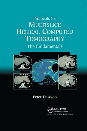 Protocols for Multislice Helical Computed Tomography: The Fundamentals de Dawson Peter