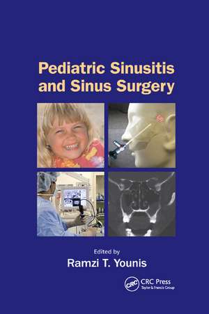 Pediatric Sinusitis and Sinus Surgery de Ramzi T. Younis