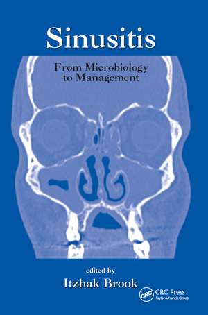 Sinusitis: From Microbiology To Management de Itzhak Brook