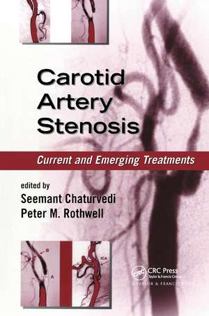 Carotid Artery Stenosis: Current and Emerging Treatments de Seemant Chaturvedi