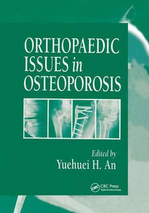 Orthopaedic Issues in Osteoporosis de Yuehuei H. An