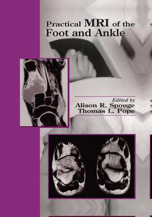 Practical MRI of the Foot and Ankle de Alison R. Spouge