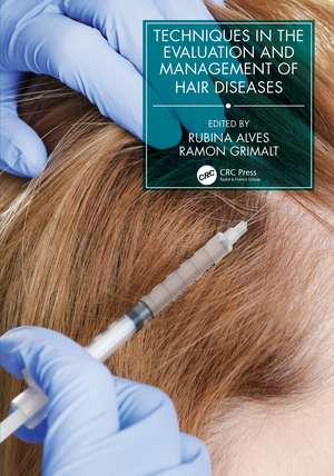 Techniques in the Evaluation and Management of Hair Diseases de Rubina Alves