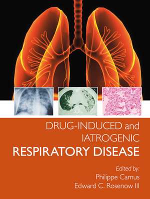 Drug-induced and Iatrogenic Respiratory Disease de Phillipe Camus