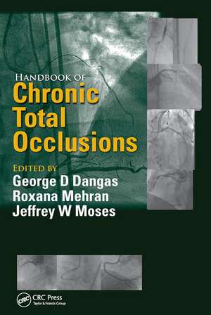 Handbook of Chronic Total Occlusions de George D. Dangas