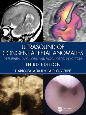 Ultrasound of Congenital Fetal Anomalies: Differential Diagnosis and Prognostic Indicators de Dario Paladini