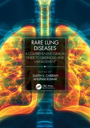 Rare Lung Diseases: A Comprehensive Clinical Guide to Diagnosis and Management de Sujith V. Cherian