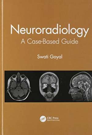 Neuroradiology: A Case-Based Guide de Swati Goyal