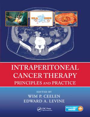 Intraperitoneal Cancer Therapy: Principles and Practice de Wim P. Ceelen