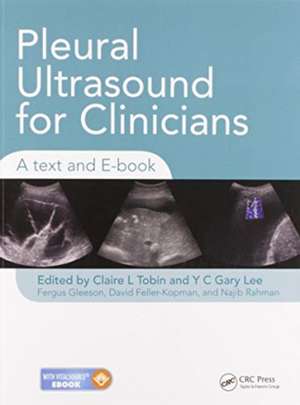 Pleural Ultrasound for Clinicians: A Text and E-book de Claire Tobin