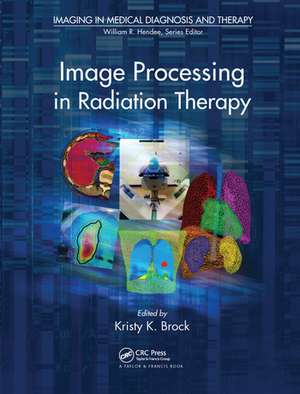 Image Processing in Radiation Therapy de Kristy K. Brock