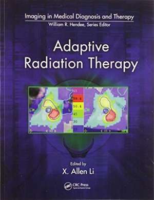 Adaptive Radiation Therapy de X. Allen Li