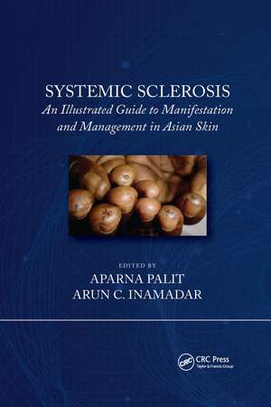 Systemic Sclerosis: An Illustrated Guide to Manifestation and Management in Asian Skin de Arun C Inamadar