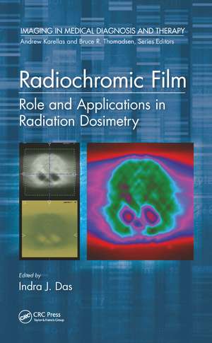 Radiochromic Film: Role and Applications in Radiation Dosimetry de Indra J. Das