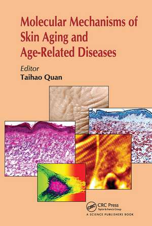 Molecular Mechanisms of Skin Aging and Age-Related Diseases de Taihao Quan