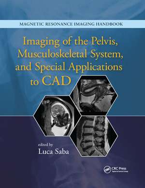 Imaging of the Pelvis, Musculoskeletal System, and Special Applications to CAD de Luca Saba