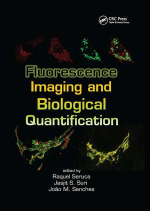 Fluorescence Imaging and Biological Quantification de Raquel Seruca