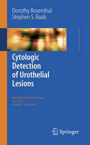 Cytologic Detection of Urothelial Lesions de Dorothy L. Rosenthal