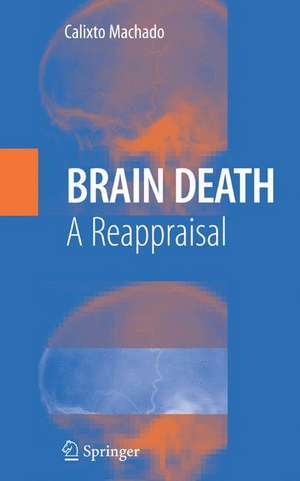 Brain Death: A Reappraisal de C. Machado