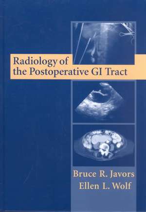 Radiology of the Postoperative GI Tract de Bruce R. Javors