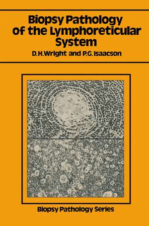 Biopsy Pathology of the Lymphoreticular System de Dennis H. Wright